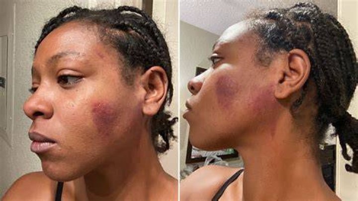 
Who is Karen Ivery? Black woman punched by Target officer Zach Cotter after demanding reparations for $1K bill 